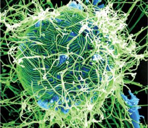 Ebola in Nigeria: NCDC Announces Two Suspected Cases