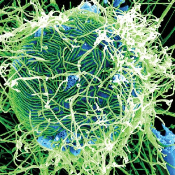 Ebola in Nigeria: NCDC Announces Two Suspected Cases