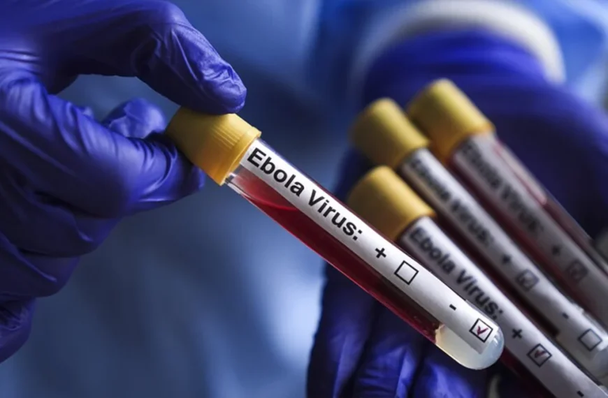 Ebola: Nigeria not yet free despite index patient’s evacuation, experts warn